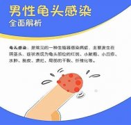 真菌龟头炎可以治愈吗？